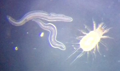 Soil Nematode